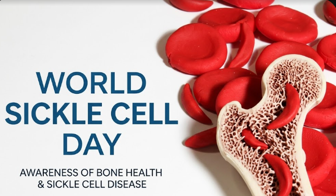 World Sickle Cell Day 2026: From “Closing the Survival Gap” to a New Era of Cure, Care and Equity